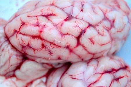 Fresh brain